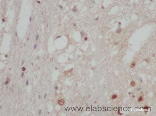 Immunohistochemistry of paraffin-embedded Rat brain using STAT2 Polyclonal Antibody at dilution of 1:50
