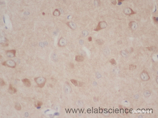 Immunohistochemistry of paraffin-embedded Mouse brain using TLR1 Polyclonal Antibody at dilution of 1:50