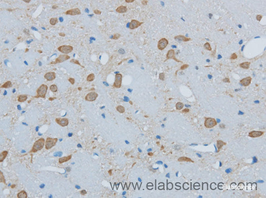 Immunohistochemistry of paraffin-embedded Mouse brain using TIMP4 Polyclonal Antibody at dilution of 1:50