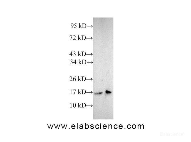 Western Blot analysis of A431 and Jurkat cells using CFL1 Polyclonal Antibody at dilution of 1:600