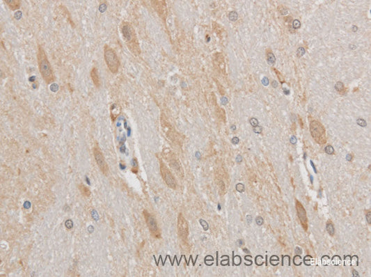 Immunohistochemistry of paraffin-embedded Mouse brain using MAP2 Polyclonal Antibody at dilution of 1:50