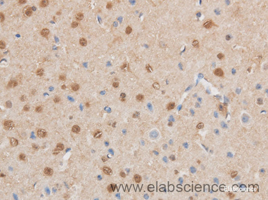 Immunohistochemistry of paraffin-embedded Mouse brain using MAP2K6 Polyclonal Antibody at dilution of 1:50