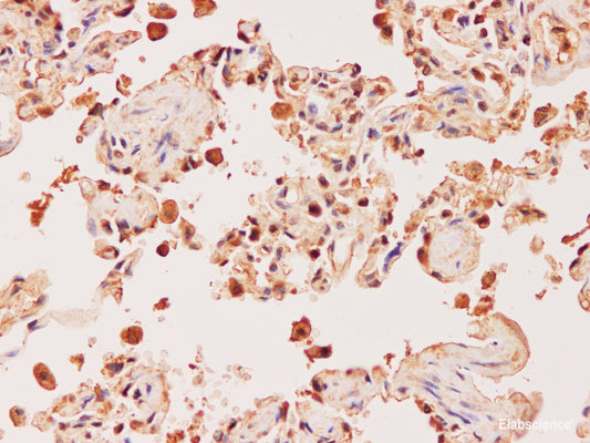 Immunohistochemistry of paraffin-embedded Human lung using EDN1 Polyclonal Antibody at dilution of 1:200