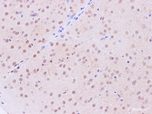 Immunohistochemistry of paraffin-embedded Mouse brain using Tinagl1 Polyclonal Antibody at dilution of 1:200