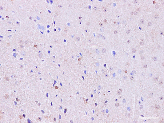 Immunohistochemistry of paraffin-embedded Mouse brain using Hoxa1 Polyclonal Antibody at dilution of 1:100