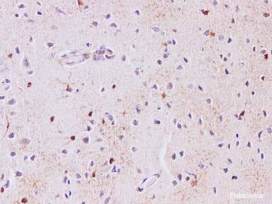 Immunohistochemistry of paraffin-embedded Rat brain using S100b Polyclonal Antibody at dilution of 1:200
