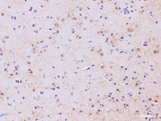 Immunohistochemistry of paraffin-embedded Mouse brain using GAD1 Polyclonal Antibody at dilution of 1:200