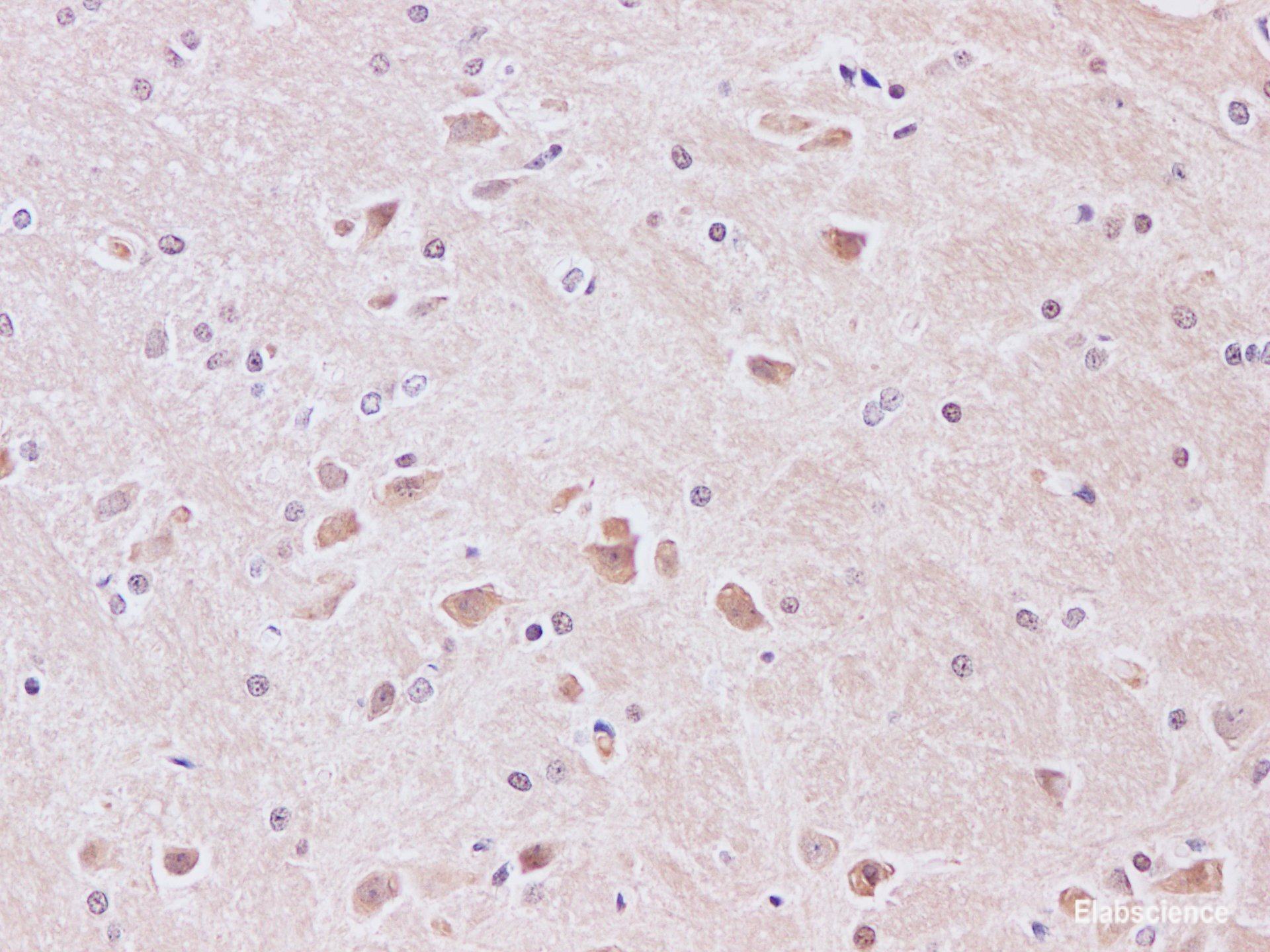 Immunohistochemistry of paraffin-embedded Rat brain using JNK1 Polyclonal Antibody at dilution of 1:200