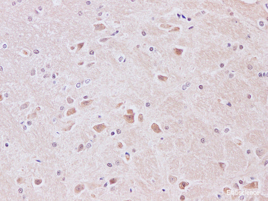Immunohistochemistry of paraffin-embedded Rat brain using JNK1 Polyclonal Antibody at dilution of 1:200