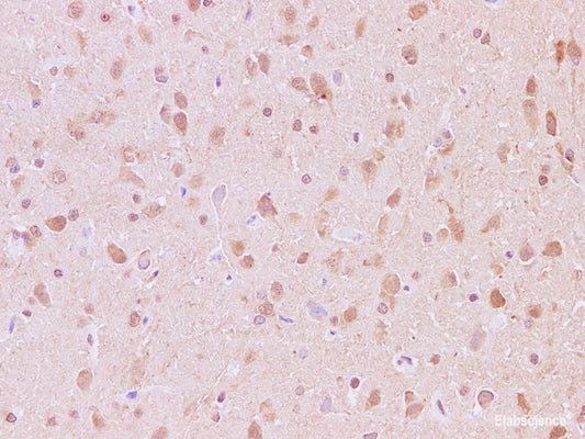 Immunohistochemistry of paraffin-embedded Rat brain using JNK2 Polyclonal Antibody at dilution of 1:200