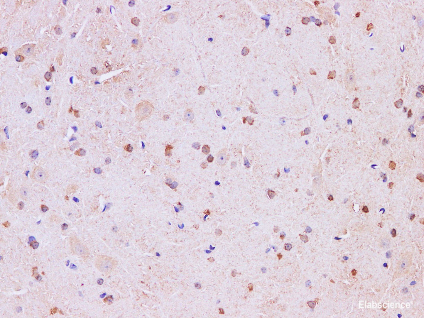 Immunohistochemistry of paraffin-embedded Mouse brain using Mark4  Polyclonal Antibody at dilution of 1:200