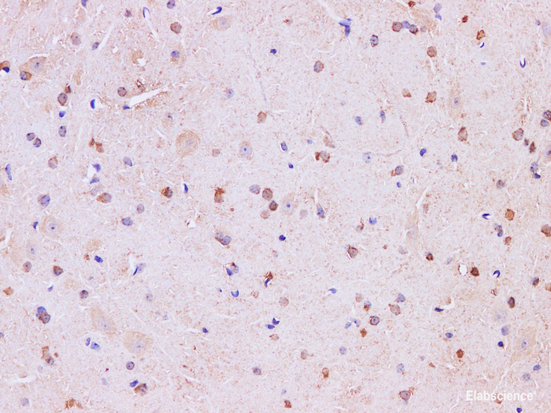 Immunohistochemistry of paraffin-embedded Mouse brain using Mark4  Polyclonal Antibody at dilution of 1:200