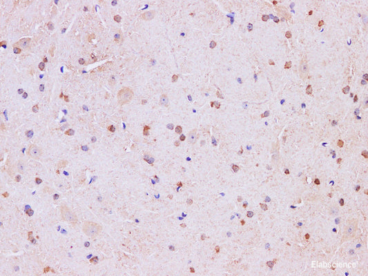 Immunohistochemistry of paraffin-embedded Mouse brain using Mark4  Polyclonal Antibody at dilution of 1:200