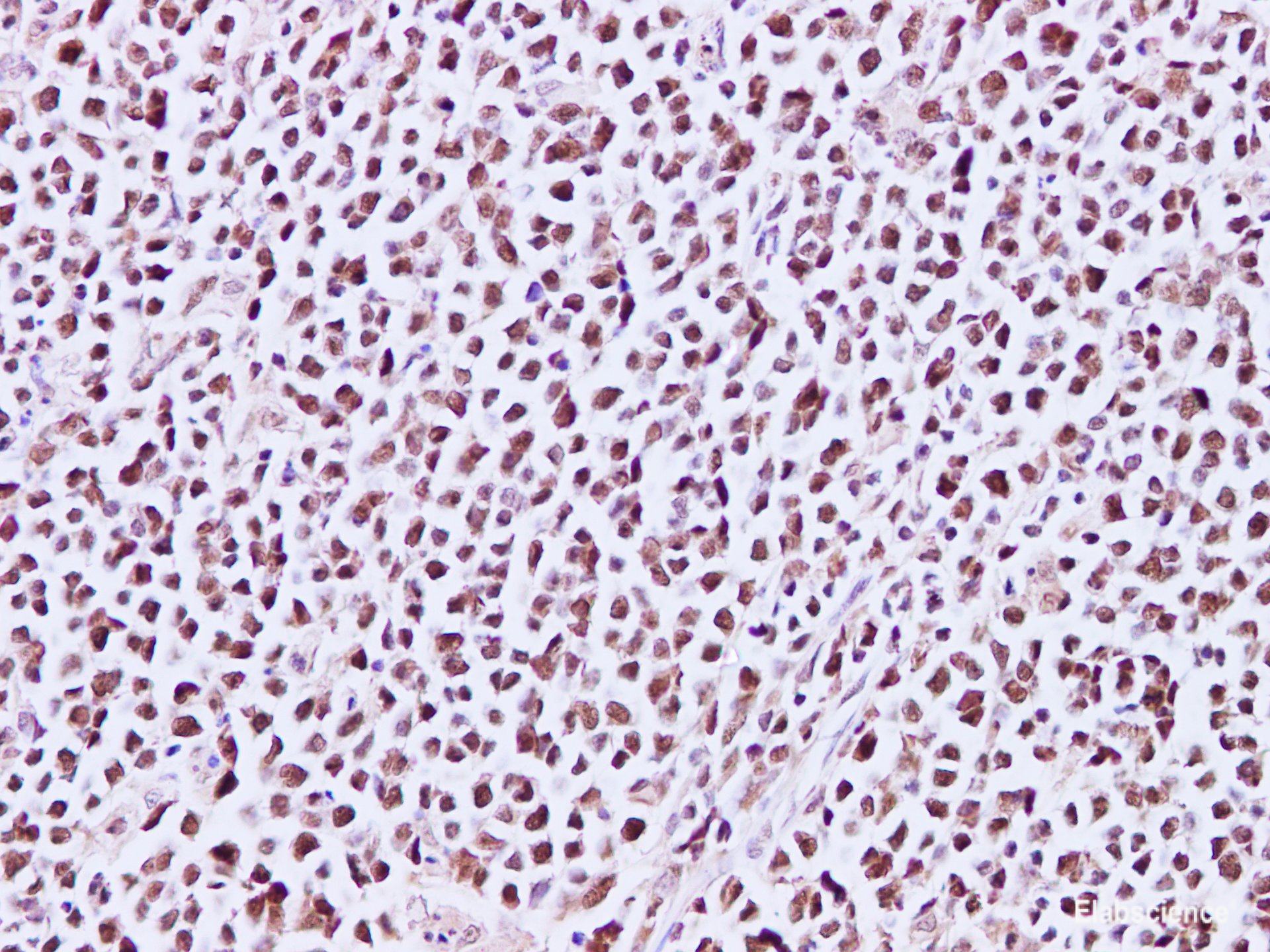 Immunohistochemistry of paraffin-embedded Human lymph node using MCM3 Polyclonal Antibody at dilution of 1:200