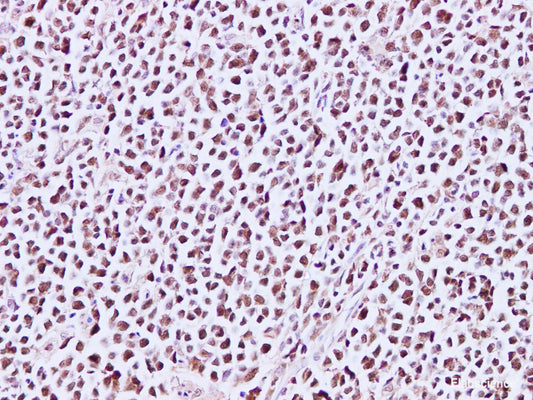 Immunohistochemistry of paraffin-embedded Human lymph node using MCM3 Polyclonal Antibody at dilution of 1:200