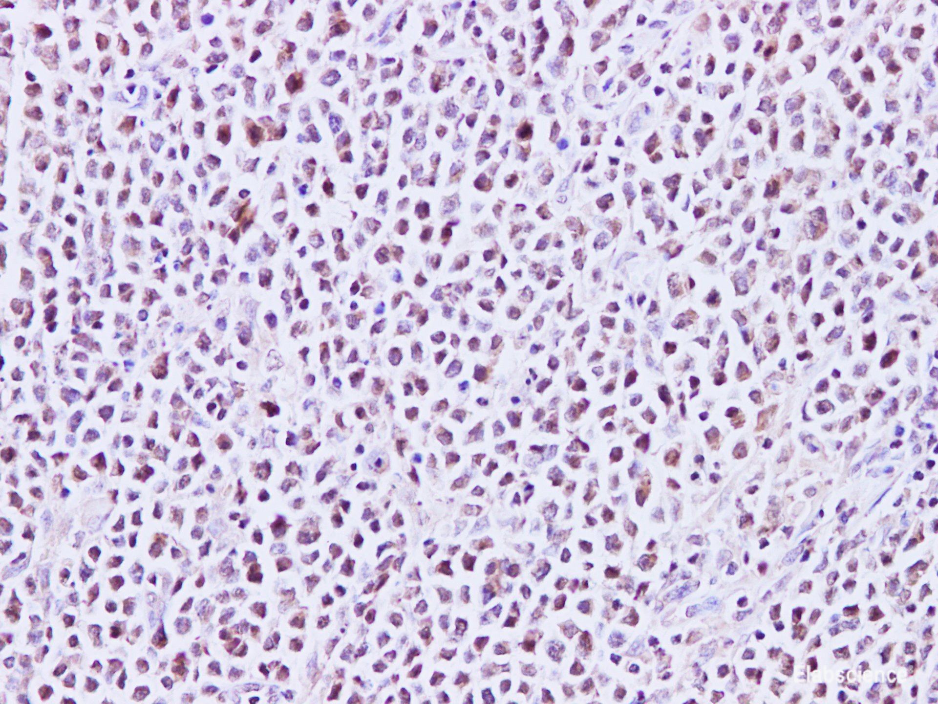 Immunohistochemistry of paraffin-embedded Human lymph node using MEF-2C Polyclonal Antibody at dilution of 1:200