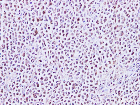 Immunohistochemistry of paraffin-embedded Human lymph node using MEF-2C Polyclonal Antibody at dilution of 1:200
