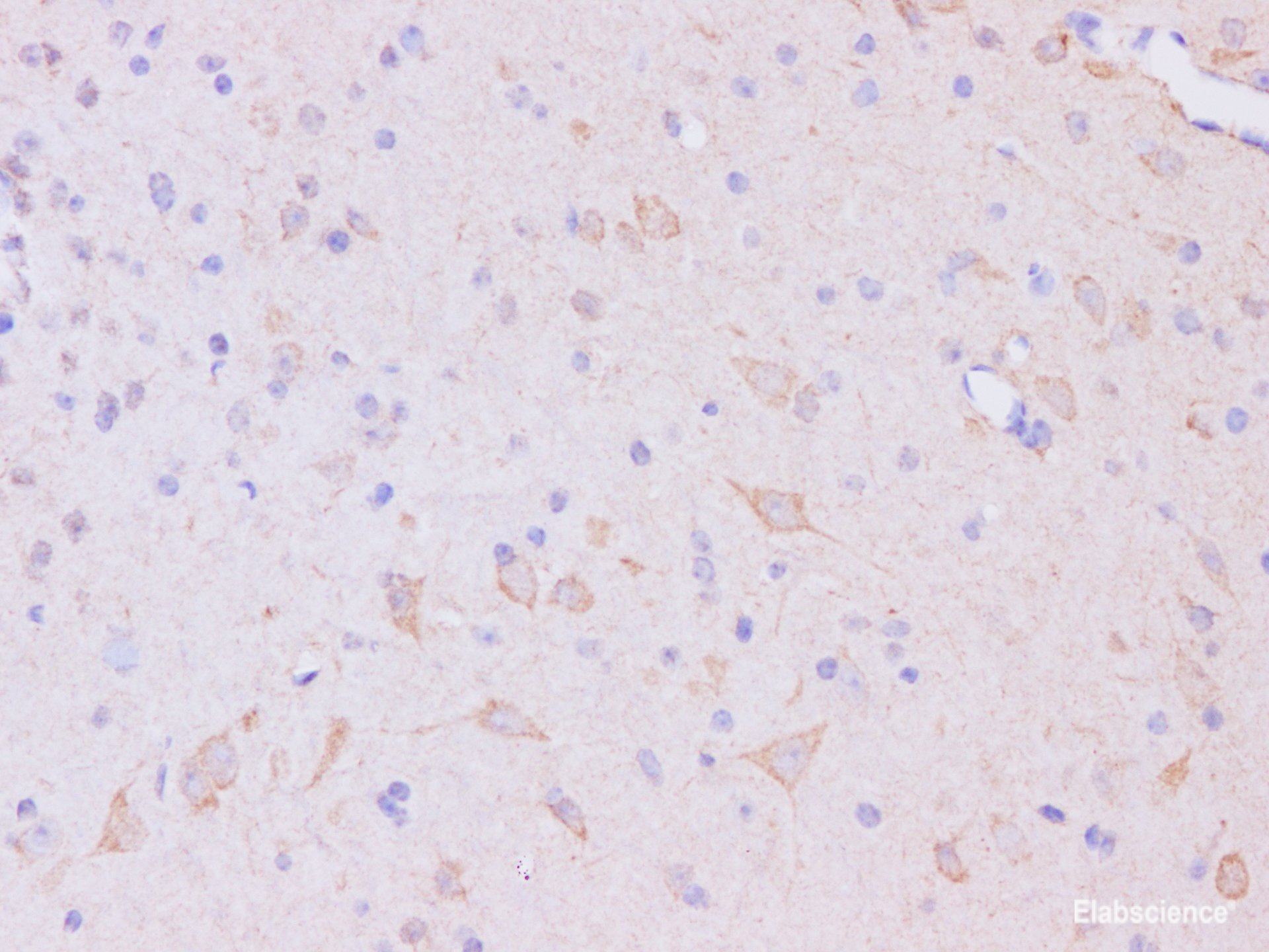 Immunohistochemistry of paraffin-embedded Mouse brain using Trim37 Polyclonal Antibody at dilution of 1:200