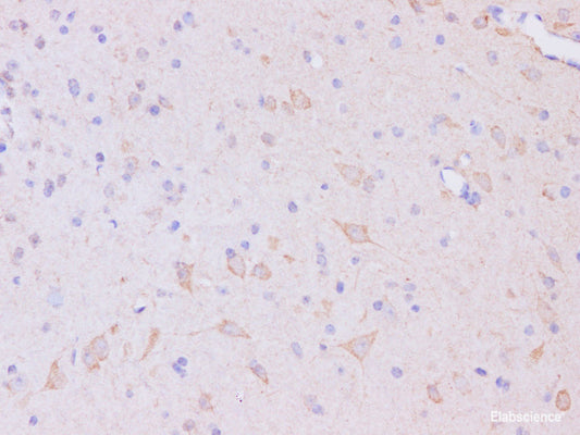 Immunohistochemistry of paraffin-embedded Mouse brain using Trim37 Polyclonal Antibody at dilution of 1:200