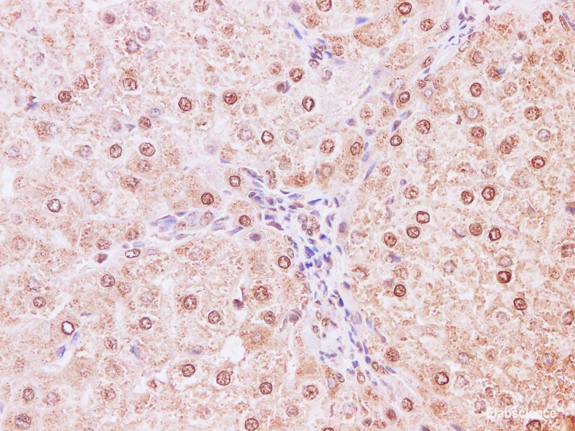 Immunohistochemistry of paraffin-embedded Human liver using NEDD8 Polyclonal Antibody at dilution of 1:200