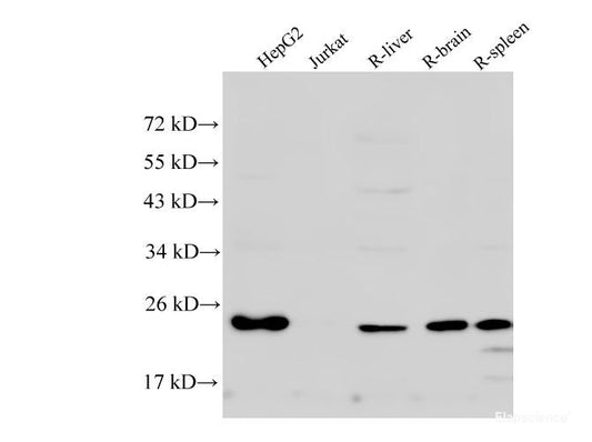 Western Blot analysis of HepG2, Jurkat cells, Rat liver, Rat brain and Rat spleen using RAN Polyclonal Antibody at dilution of 1:500