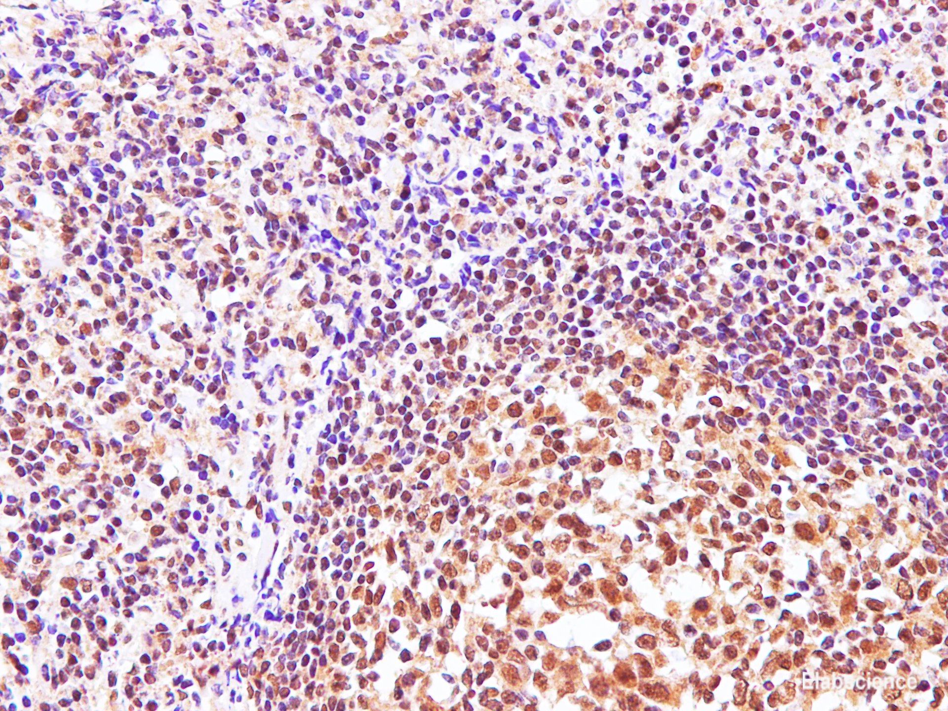 Immunohistochemistry of paraffin-embedded Human tonsil using CBX5 Polyclonal Antibody at dilution of 1:100