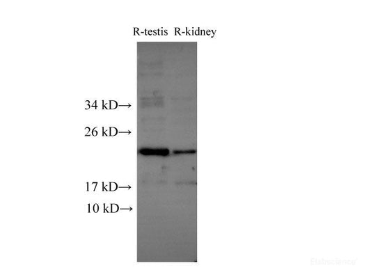 Western Blot analysis of Rat testis and Rat kidney using Runx2 Polyclonal Antibody at dilution of 1:500