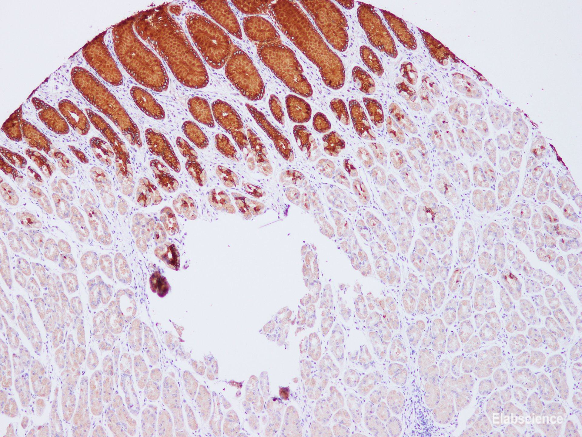 Immunohistochemistry of paraffin-embedded Human stomach using MUC5AC Polyclonal Antibody at dilution of 1:100(100×)