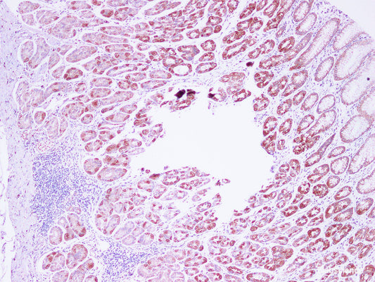 Immunohistochemistry of paraffin-embedded Human stomach using IHH Polyclonal Antibody at dilution of 1:100(100×)