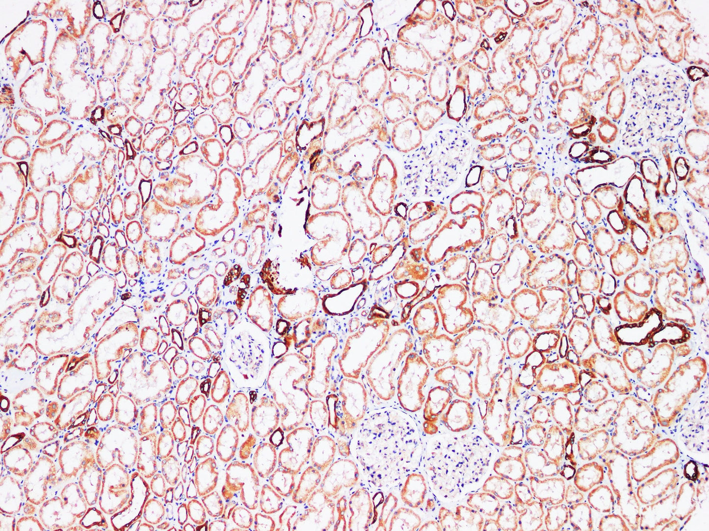 Immunohistochemistry of paraffin-embedded Human kidney using FUT3 Polyclonl Antibody at dilution of 1:200.
