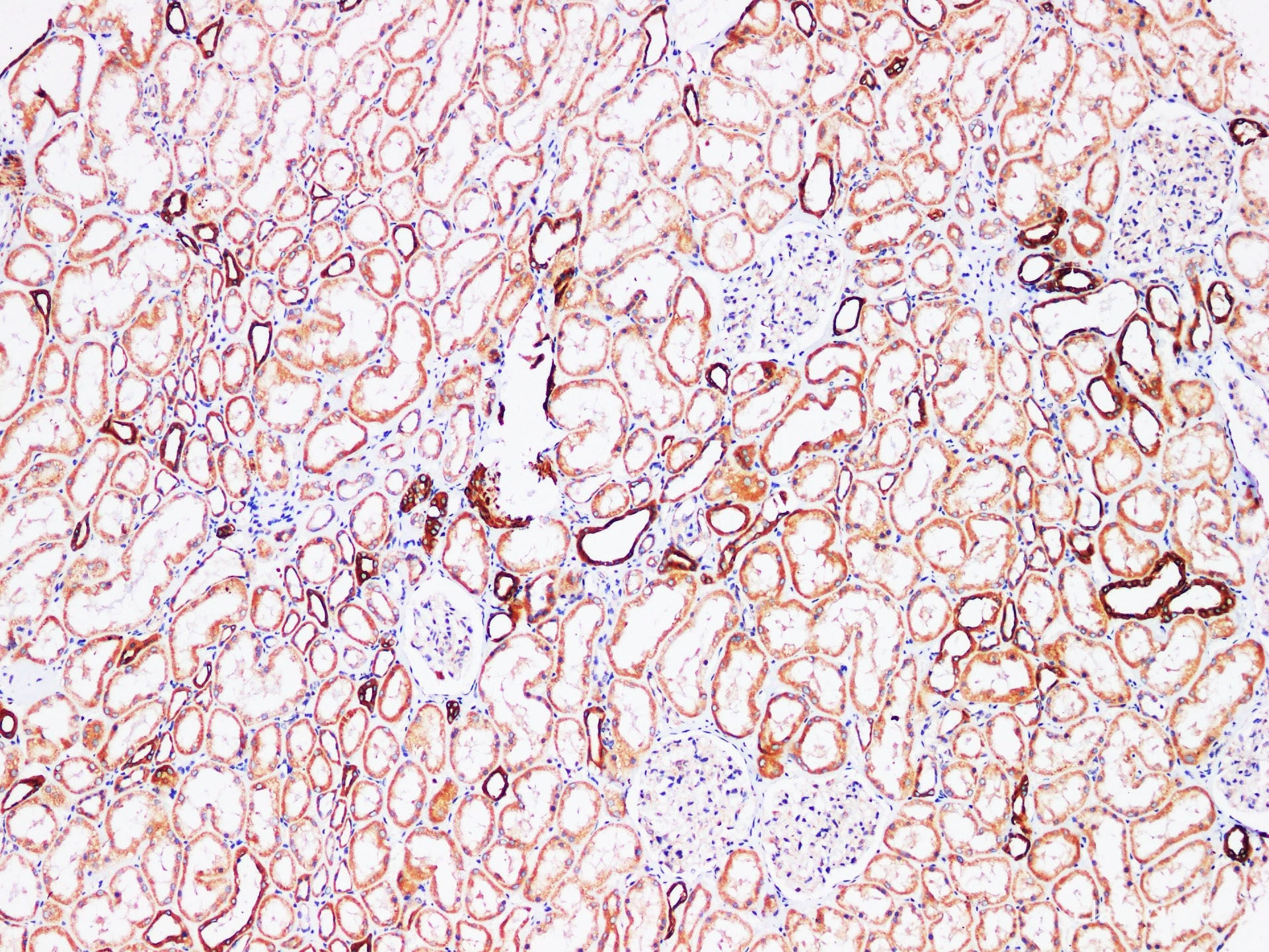 Immunohistochemistry of paraffin-embedded Human kidney using FUT3 Polyclonl Antibody at dilution of 1:200.