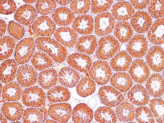 Immunohistochemistry of paraffin-embedded Mouse testis using DNMT1 Polyclonl Antibody at dilution of 1:200(100×）.