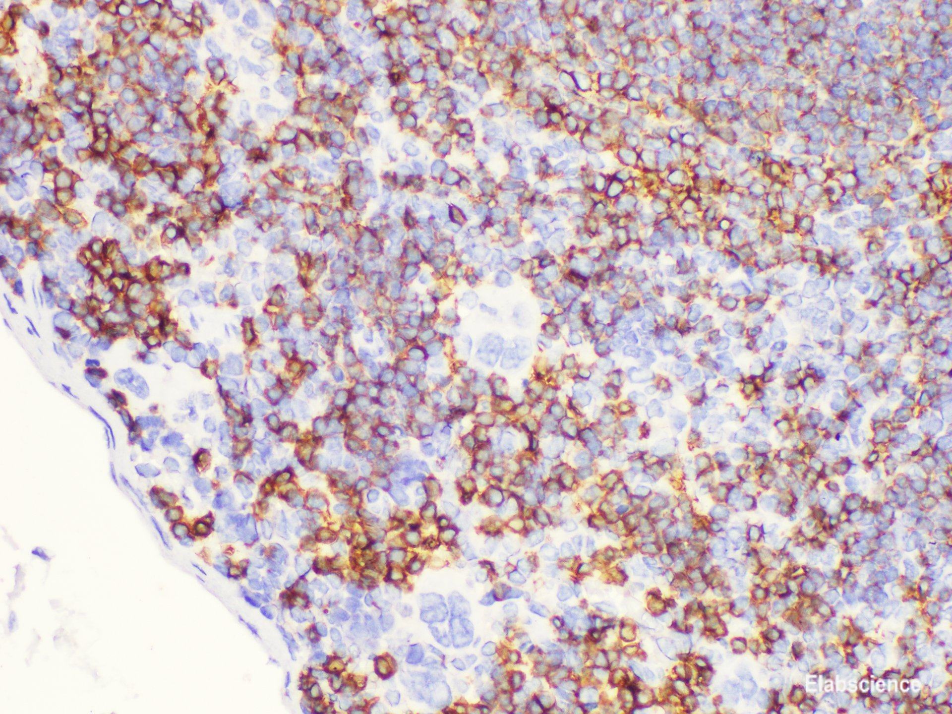 Immunohistochemistry of paraffin-embedded Mouse spleen using CD20 Polycloanl Antibody at dilution of 1:100