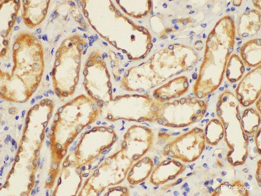 Immunohistochemistry of paraffin-embedded Human kidney using ST14 Ployclonal Antibody at dilution of 1:200.
