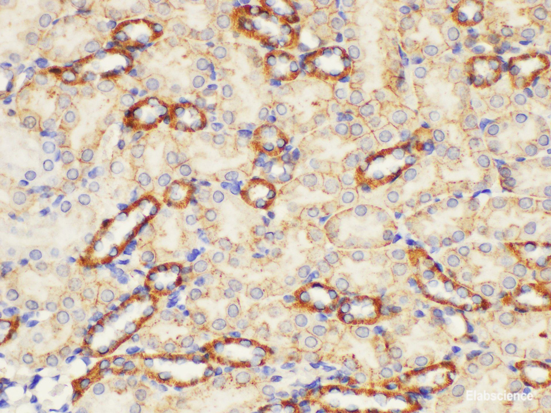 Immunohistochemistry of paraffin-embedded Mouse kidney using ST14 Ployclonal Antibody at dilution of 1:200.