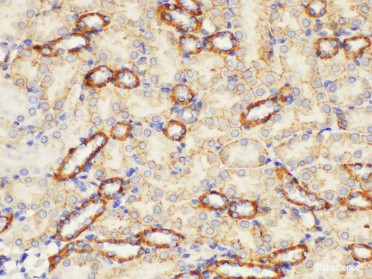 Immunohistochemistry of paraffin-embedded Mouse kidney using ST14 Ployclonal Antibody at dilution of 1:200.
