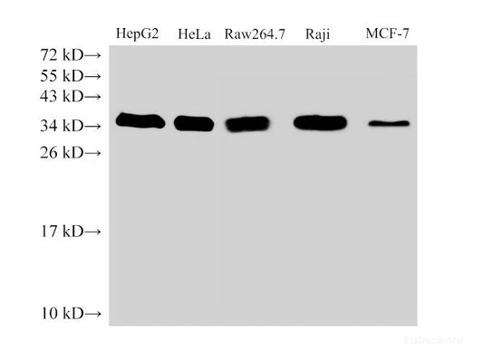 Western Blot analysis of HepG2, Hela, Raw264.7 Raji and MCF-7 cells using PCNA Polyclonal Antibody at dilution of 1:500