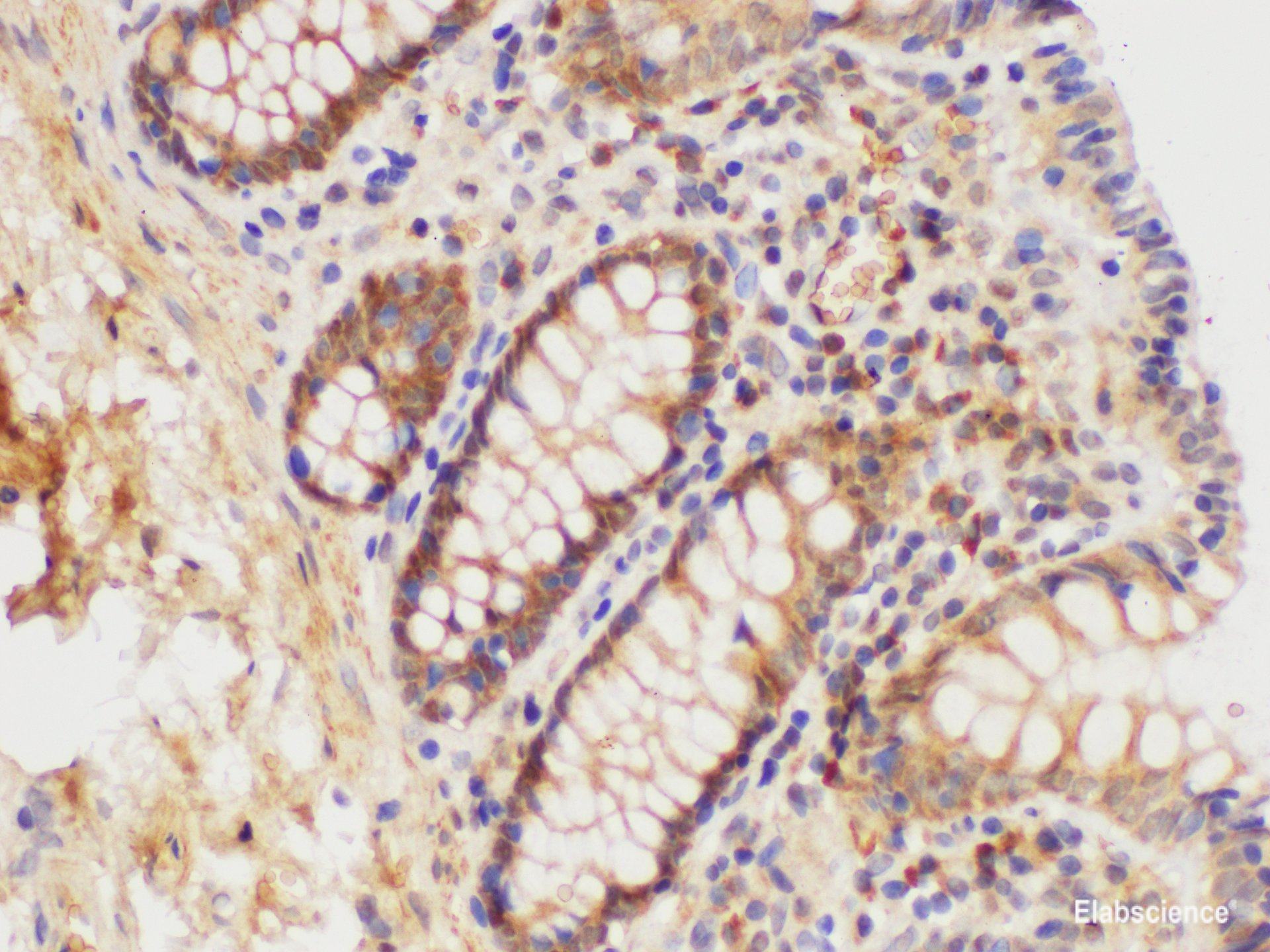 Immunohistochemistry of paraffin-embedded Human colon using S100A6 Polycloanl Antibody at dilution of 1:100