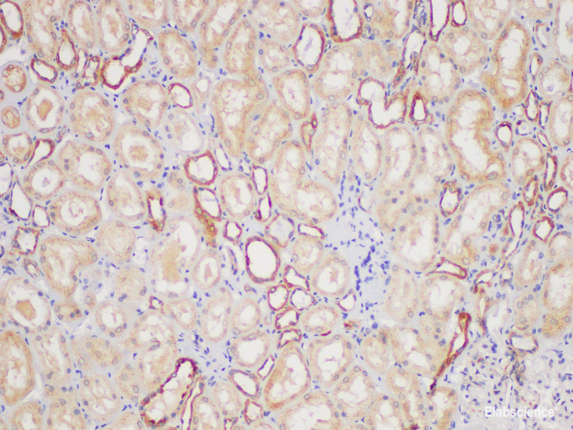 Immunohistochemistry of paraffin-embedded Human kidney using FGFR3 Polycloanl Antibody at dilution of 1:100