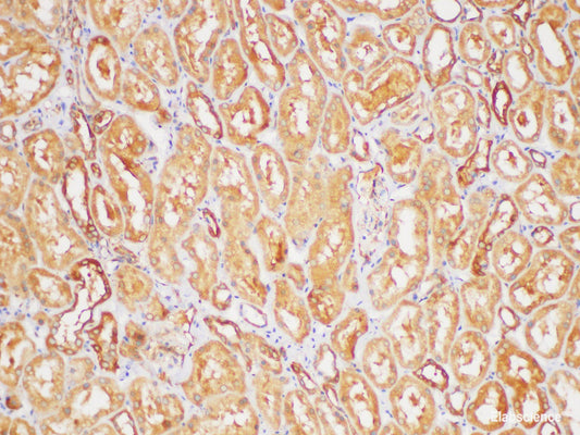Immunohistochemistry of paraffin-embedded Human kidney using TGFB2 Polycloanl Antibody at dilution of 1:200