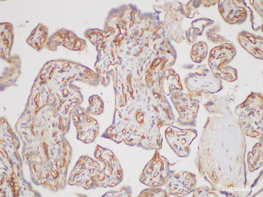 Immunohistochemistry of paraffin-embedded Human placenta using TGFBR2 Polycloanl Antibody at dilution of 1:170