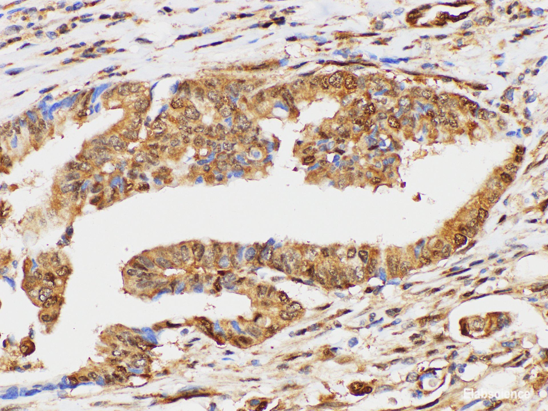 Immunohistochemistry of paraffin-embedded Human duodenum using UBC Polycloanl Antibody at dilution of 1:100