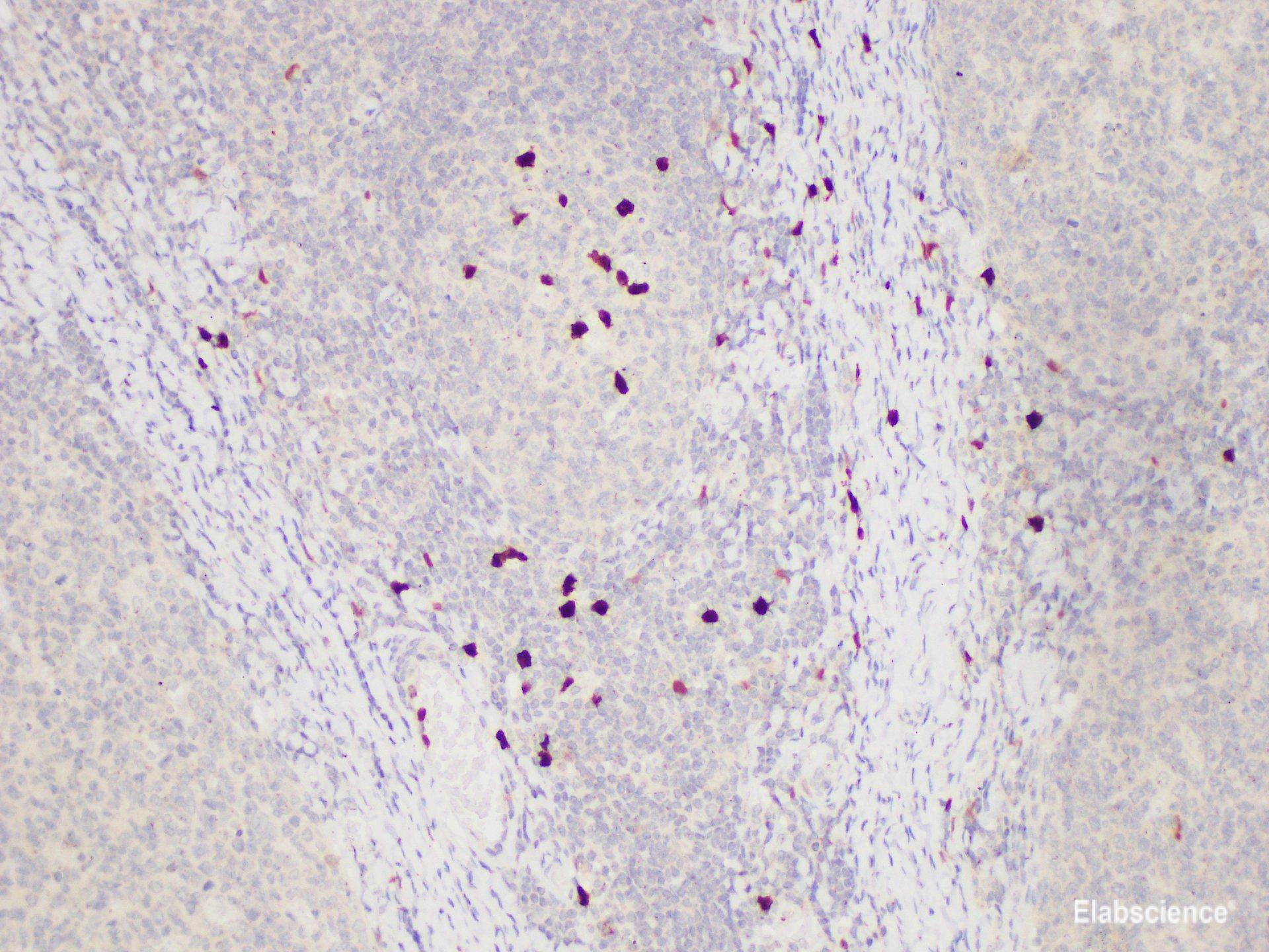 Immunohistochemistry of paraffin-embedded Human tonsil using S100A12 Polycloanl Antibody at dilution of 1:85