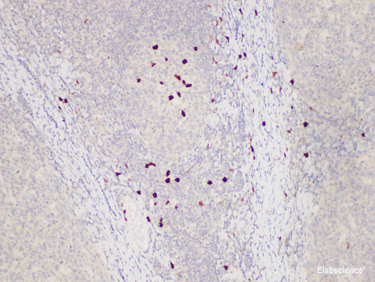 Immunohistochemistry of paraffin-embedded Human tonsil using S100A12 Polycloanl Antibody at dilution of 1:85