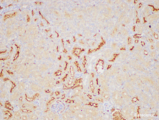 Immunohistochemistry of paraffin-embedded Mouse kidney using ANGPT2 Polycloanl Antibody at dilution of 1:200
