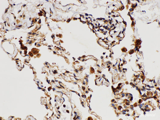 Immunohistochemistry of paraffin-embedded Human lung using IL1RAP Polycloanl Antibody at dilution of 1:150