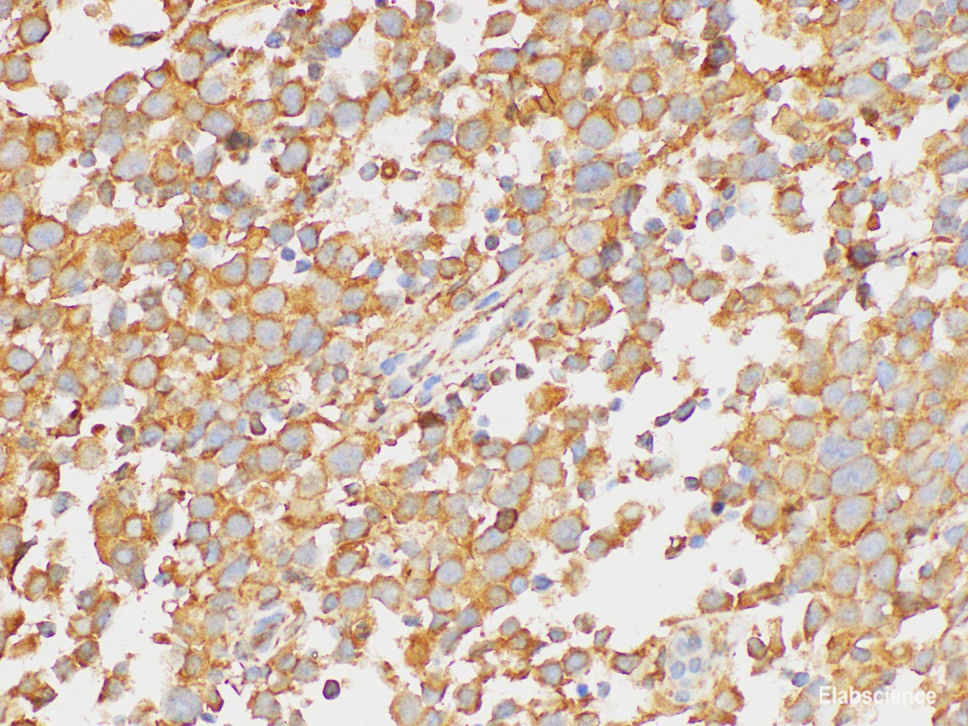 Immunohistochemistry of paraffin-embedded Human testis using PAIP1 Polycloanl Antibody at dilution of 1:200