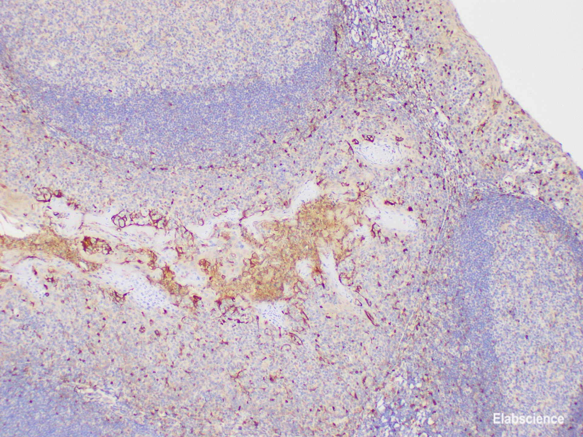 Immunohistochemistry of paraffin-embedded Human tonsil using S100A4 Polycloanl Antibody at dilution of 1:200
