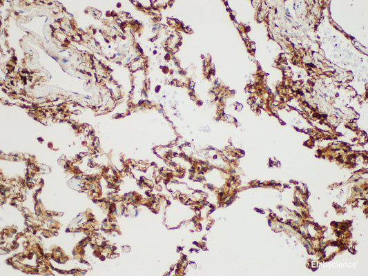 Immunohistochemistry of paraffin-embedded Human lung using S100A4 Polycloanl Antibody at dilution of 1:50