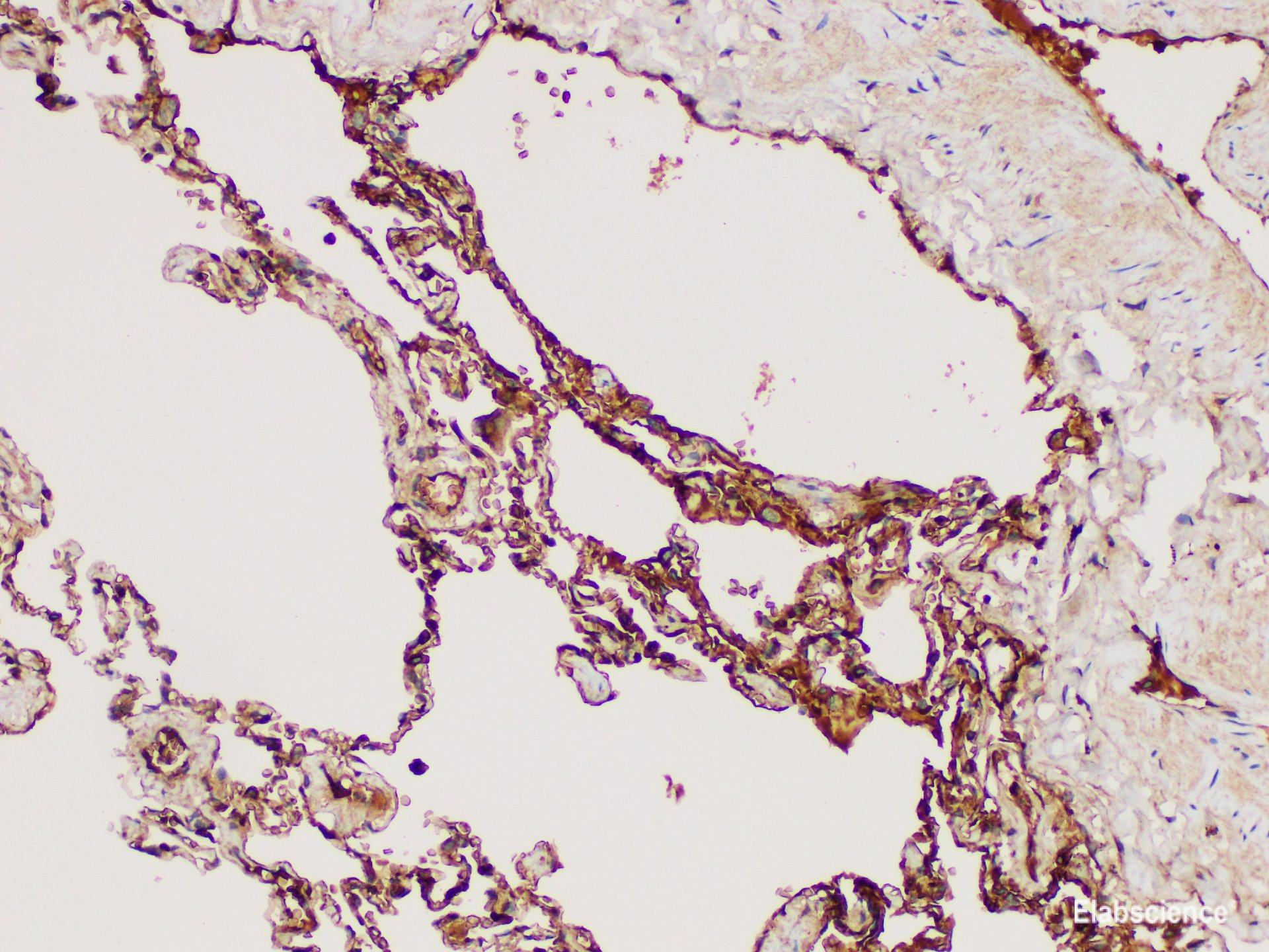 Immunohistochemistry of paraffin-embedded Human lung using DMBT1 Polycloanl Antibody at dilution of 1:300